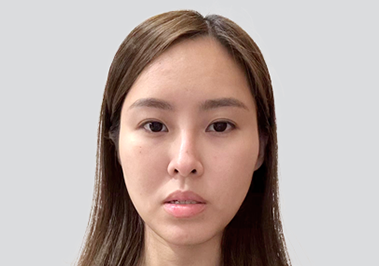 Before facial contour