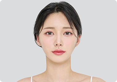 After facial contour