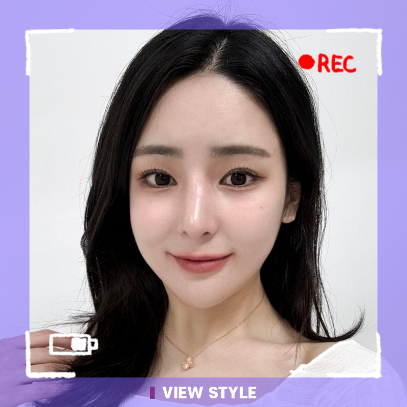 Review of Rhinoplasty, Fat Grafting, and Contouring Surgery at View Plastic Surgery in Korea