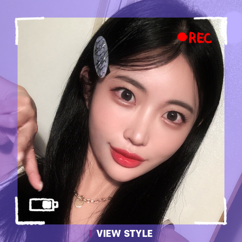 Non-incisional Double eyelid surgery Review at View Plastic Surgery