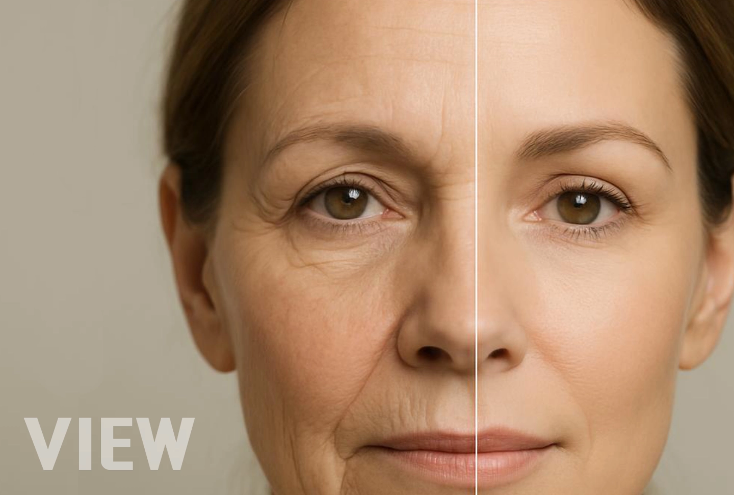 Facelift Surgery in Korea: Deep Plane vs SMAS, Which Approach Is Right for Your Face?