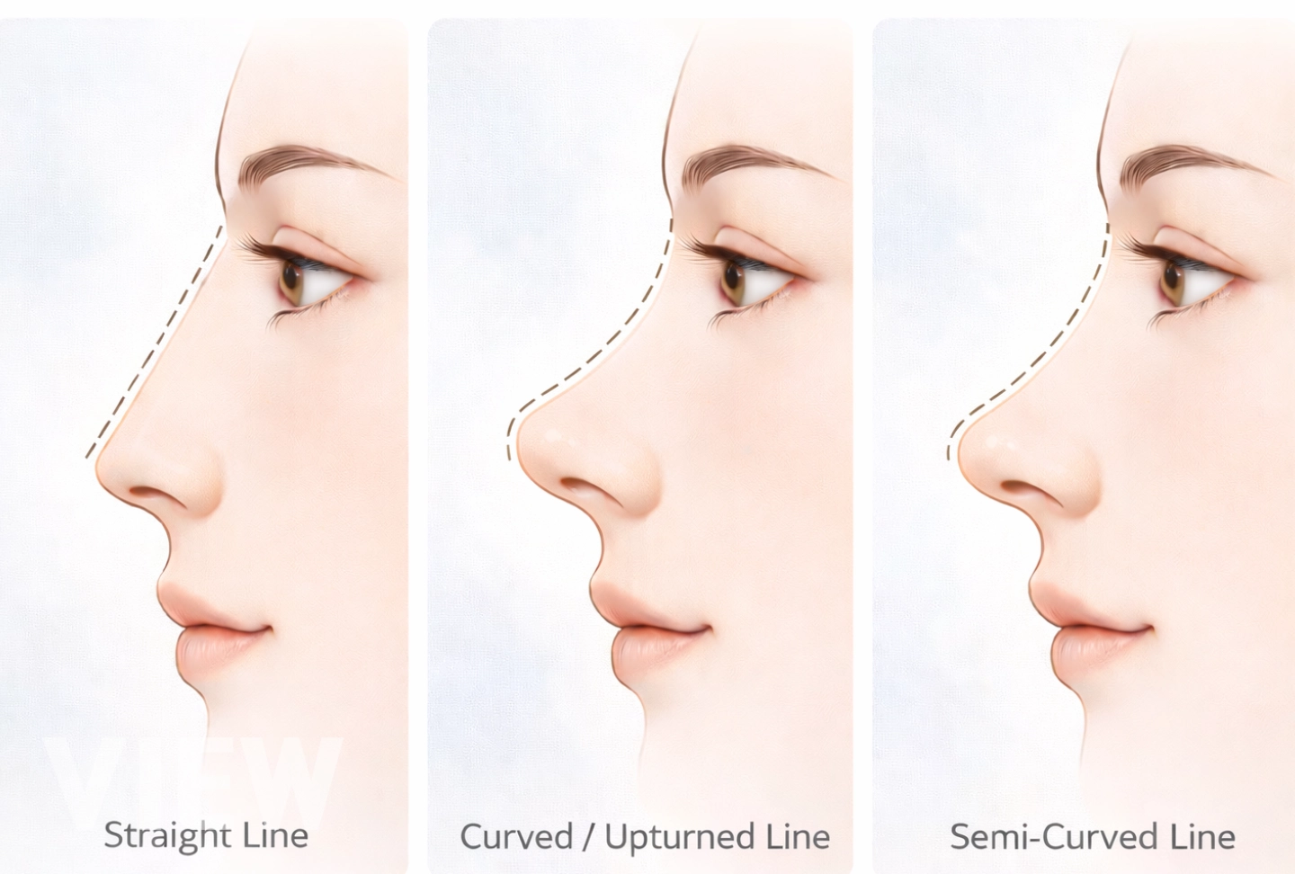 How to Find the Nose Line That Suits You Best for Korean Rhinoplasty