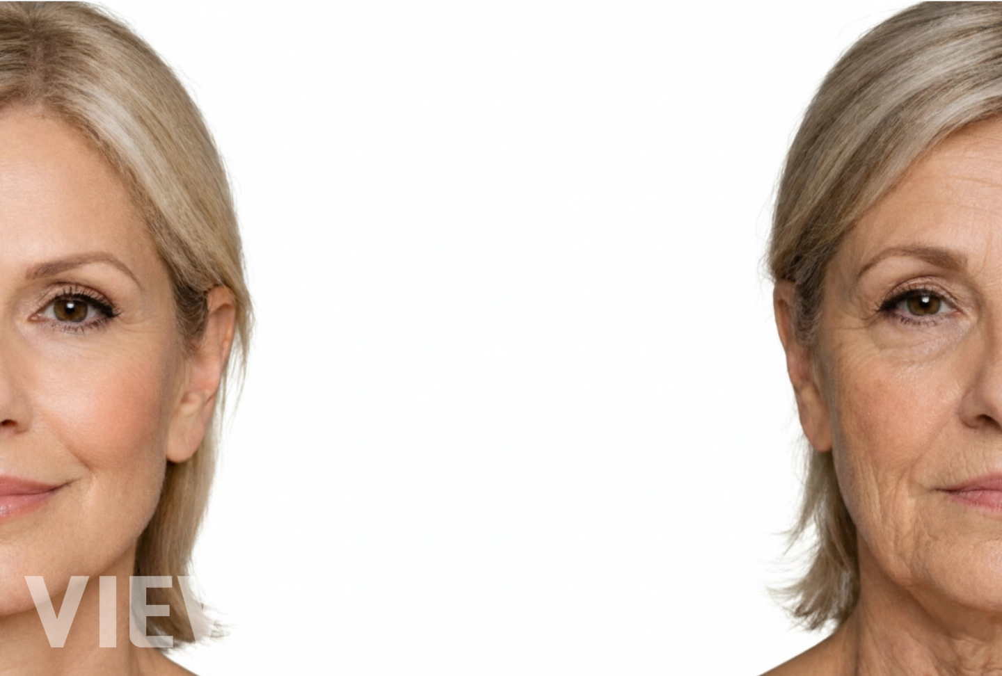 The Secret Behind Looking Younger in Your 60s: Advanced Anti-Aging Surgery