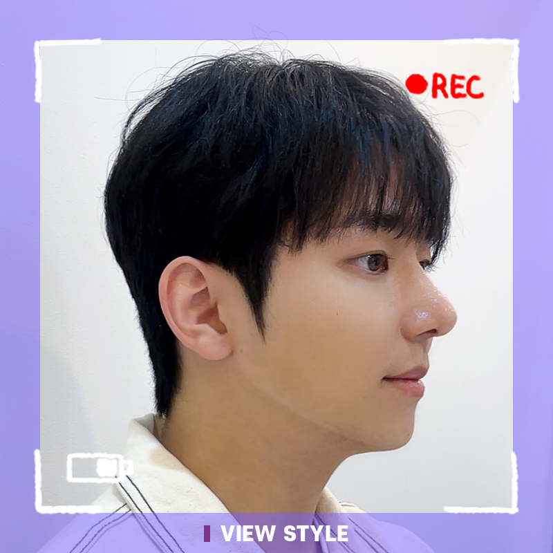 My Eye and Nose Surgery in Korea, Honest Recovery Review at VIEW Plastic Surgery