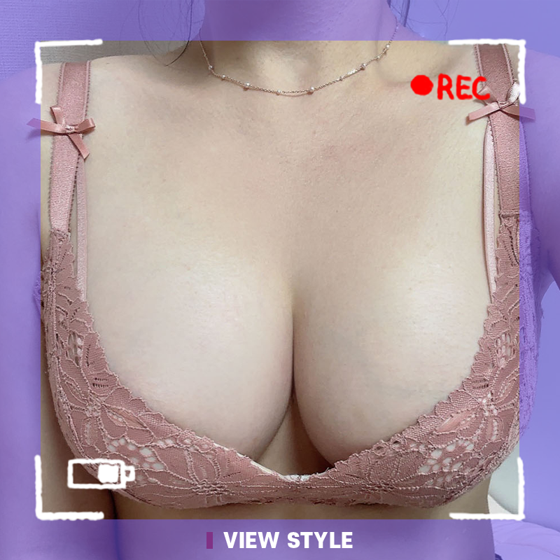 I Finally Got My Breast Augmentation at VIEW Korea