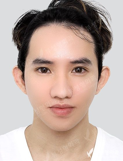 Double Jaw 01 — After