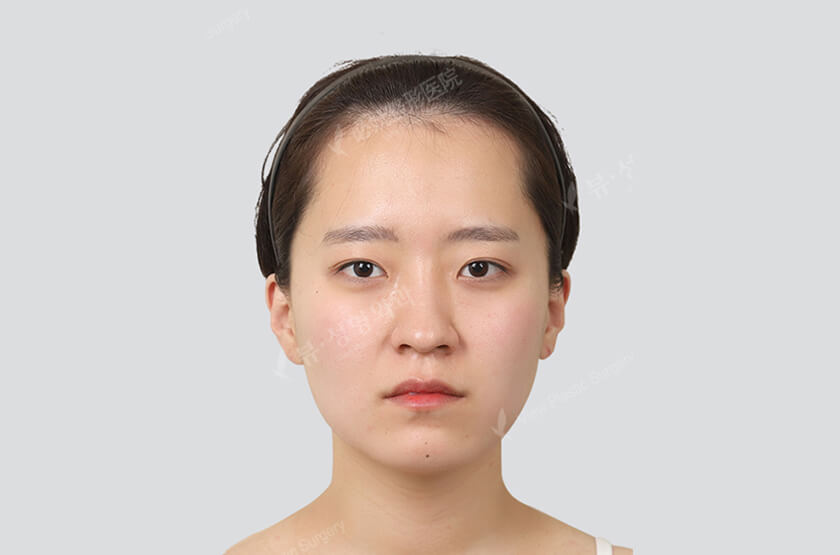 After