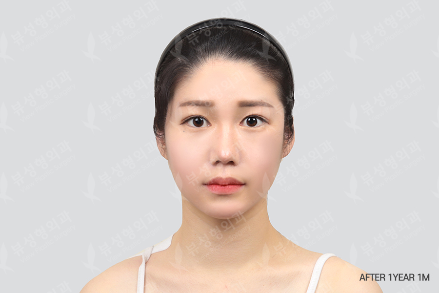 After