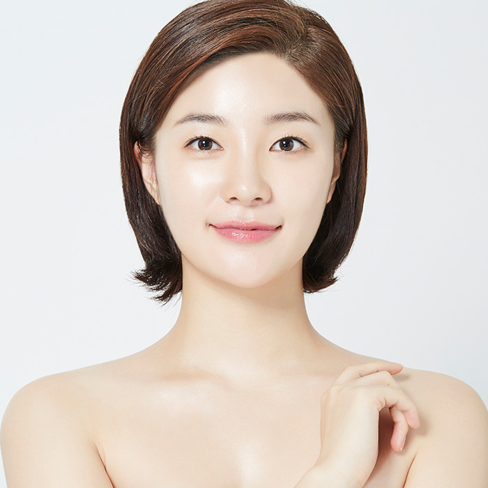 전후사진 test — After