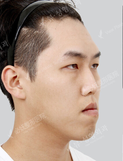 Before