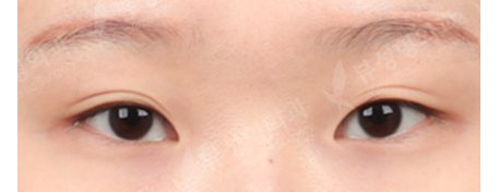 test — Before