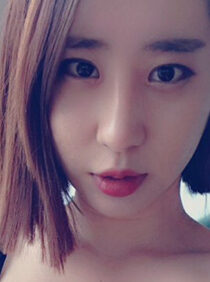 [Eye correction surgery (reoperation) + slit in the front + slit in the back + slit in the bottom] Jungmi Kim
