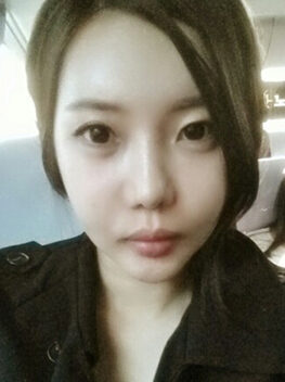 [V-line + cheekbone reduction] Kim Hyo-kyung