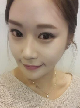 [Doll line (V line) + cheekbone reduction + slit in the back + slit in the bottom] Park Hee-jin