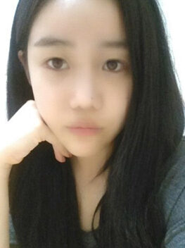 [Doll line (V line) + cheekbone reduction + nose revision surgery + Accu Lifting] Lim Ji-eun