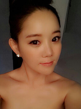 [Doll line (V line) + cheekbone reduction + anterior cheek implant + non-incision eyelid correction + eyebrow lift] Minah Lee