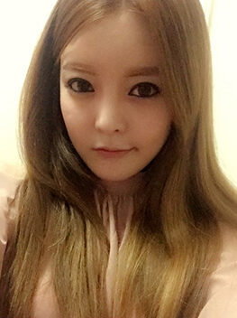 [Natural V line + cheekbone reduction + re-rhinoplasty + non-incision eyelid correction] Jungmi Kim