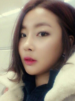 [Doll line (V line) + cheekbone reduction + anterior cheek implant + aristocratic surgery + rhinoplasty + nose reduction] Yang Eun-sook