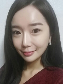[Doll line (V line) + cheekbone reduction + non-incision eyelid correction + rhinoplasty + noble surgery + fat grafting] Eunji Lee