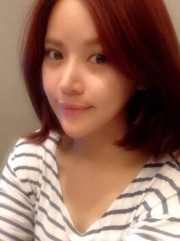 [Natural V line + cheekbone reduction + noble surgery + front cheek (prosthesis)] Yunari