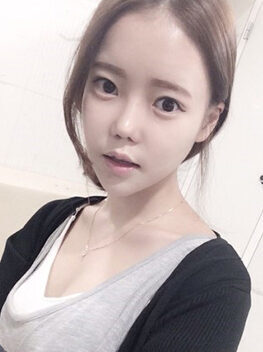 [Doll line (V line) + cheekbone reduction] Kim Young-sun