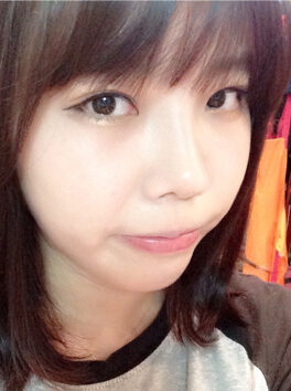 [T.O.P nose surgery] Yang Chae-ah