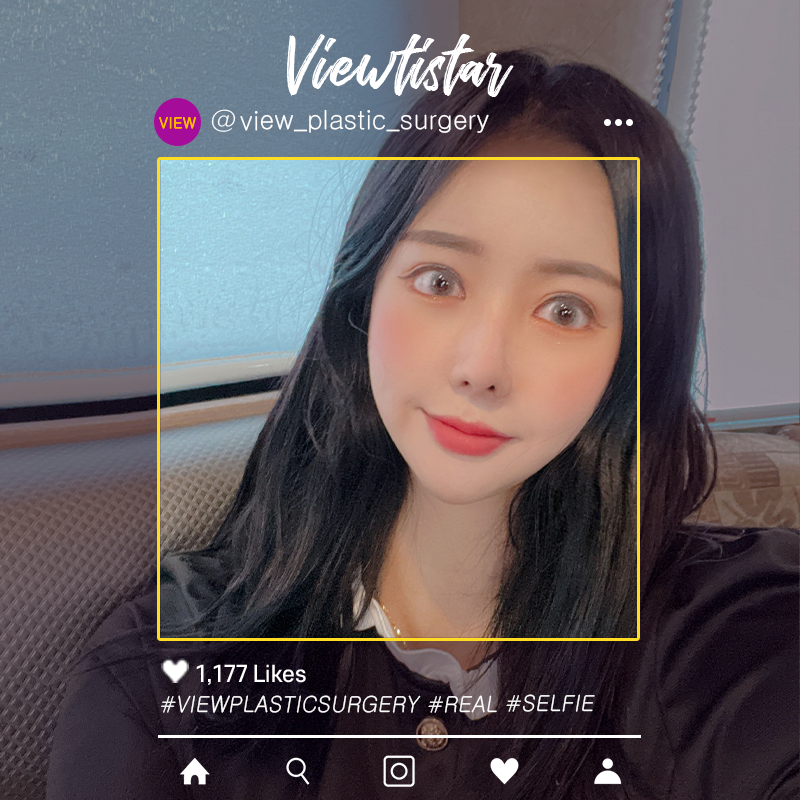 [3 Types Face Countouring+Double Eyelid Revisional Surgery+fat graft surgery+face Liposuction]