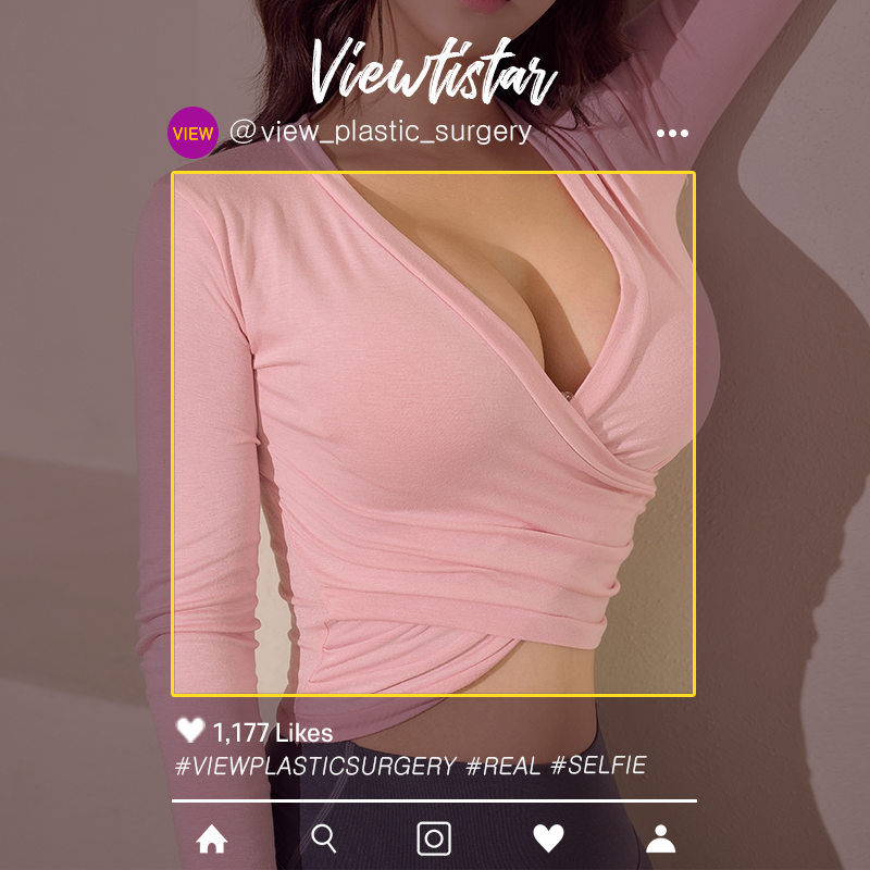[Breast Augmentation(Motiva)] Kim Rin a