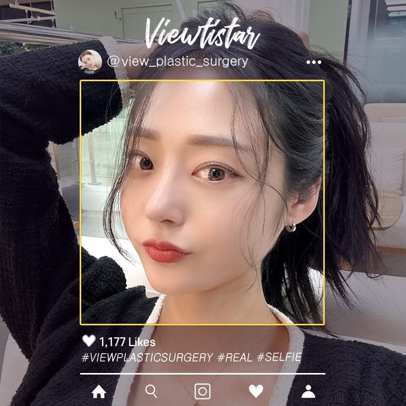 [Rhinoplasty + Under Eye Fat Reposition] Lee Hyeri | Plastic Surgery Korea