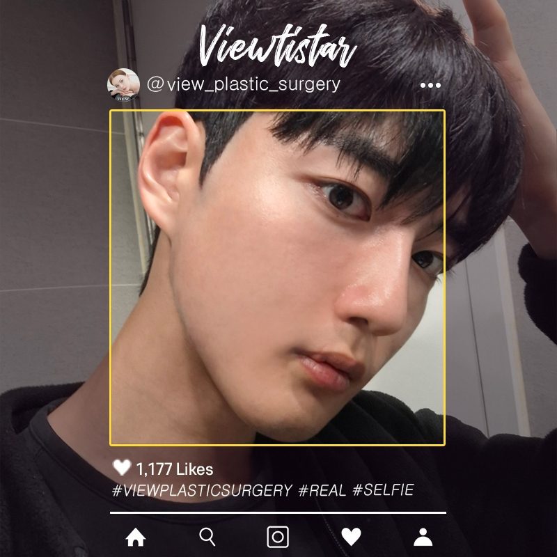 [3 Types Facial Contouring + Double Eyelid Surgery] Park Jinwon | Plastic Surgery Korea