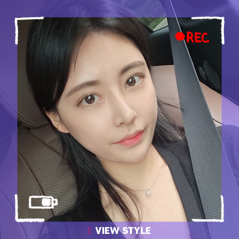 [Double Eyelid Surgery+Rhinoplasty+Fat Graft+Face Liposuction] I don’t know why I hesitated and postponed the surgery, I should have done it sooner without overthinking.