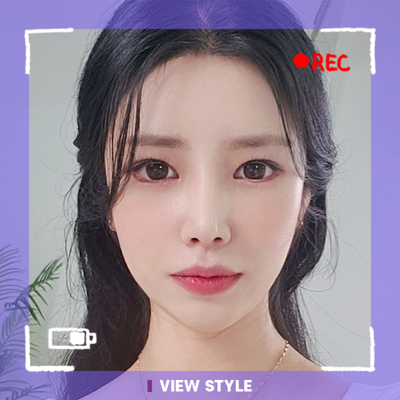 [Facial Contouring / Rhinoplasty / Double eyelid surgery] I’m living a new life. Thank you so much, and I love you.