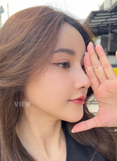 Korean Nose Surgery and Facial Contouring Review (6 Months Real Review)
